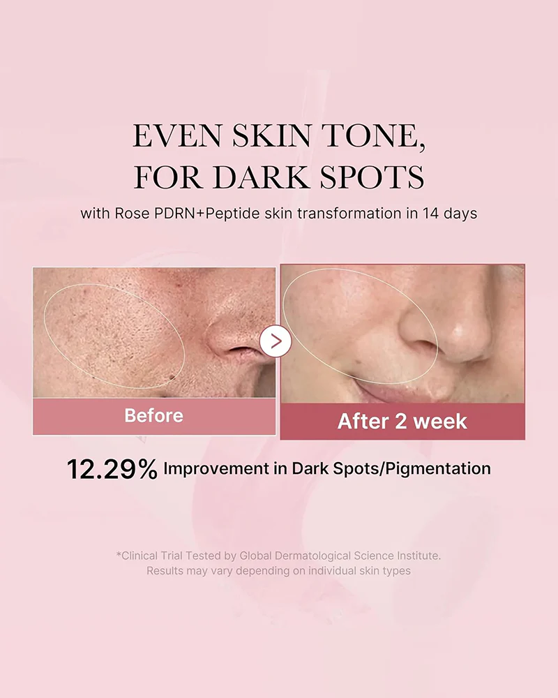 medicube PDRN Pink Niacinamide Milky Toner - Image 4